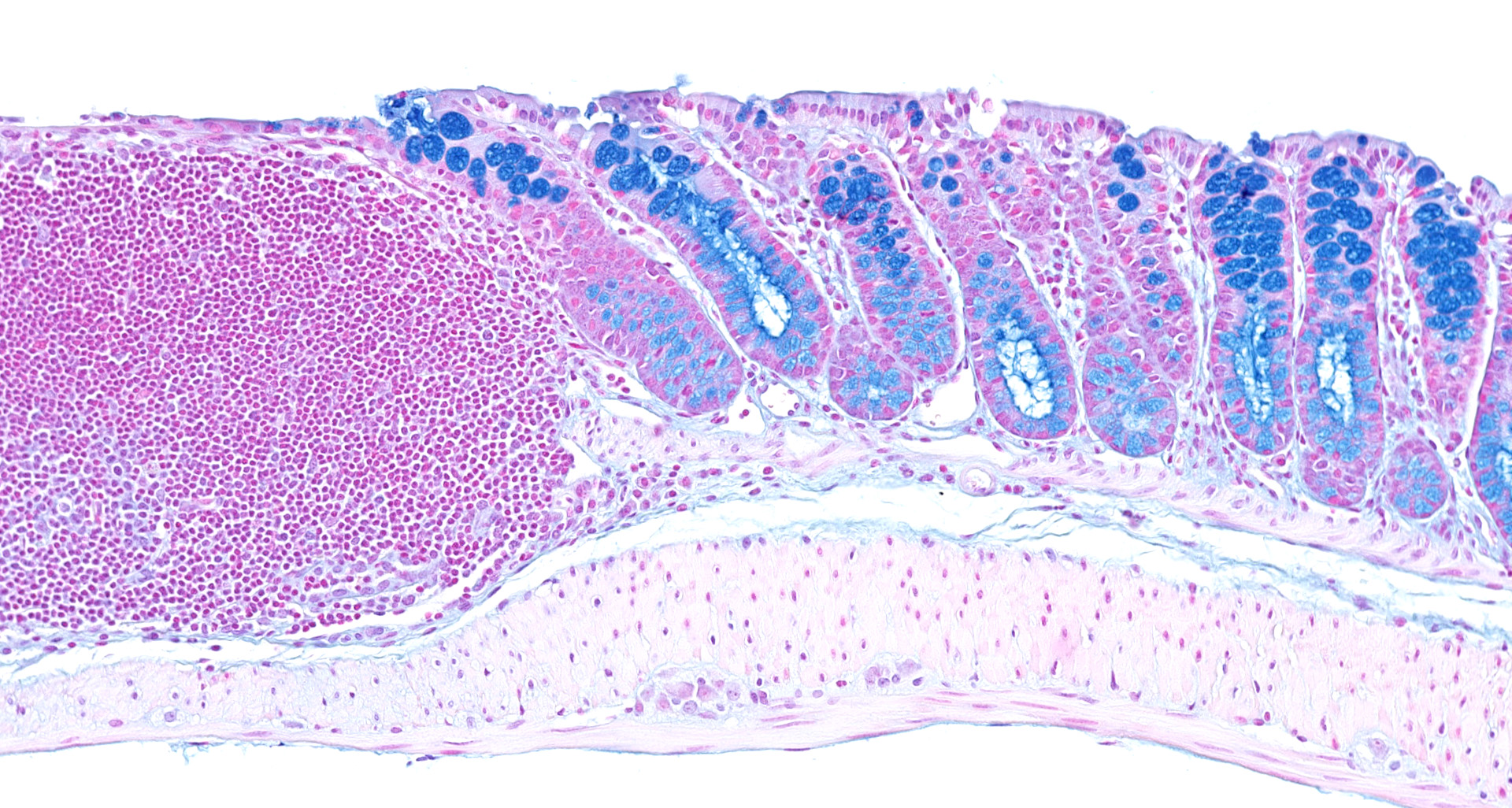 Alcian Blue / Nuclear fast red staining of mouse distal colon. Goblet cell mucins appear in blue. A large lymphoid aggregate can be seen on the left.
