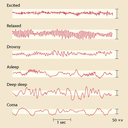 Exempel på olika EEG-rytmer