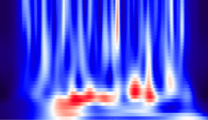 Time-Frequency analysis utifrån aktivitet från en elektrod