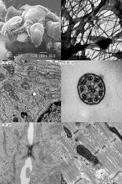 Olika bilder från elektronmikroskop