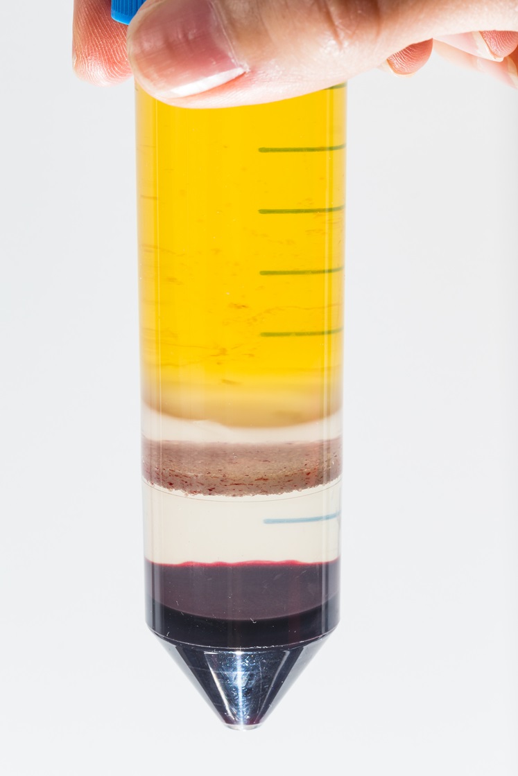 Blood sample for cell extraction