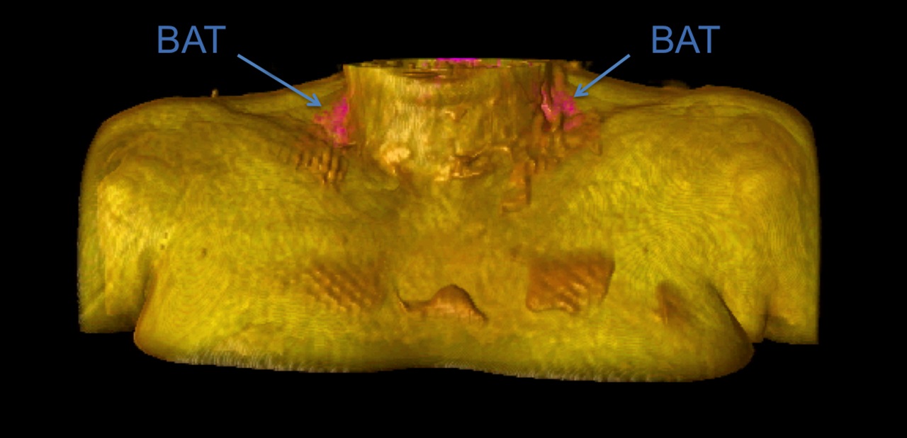 BAT - brown adipose tissue