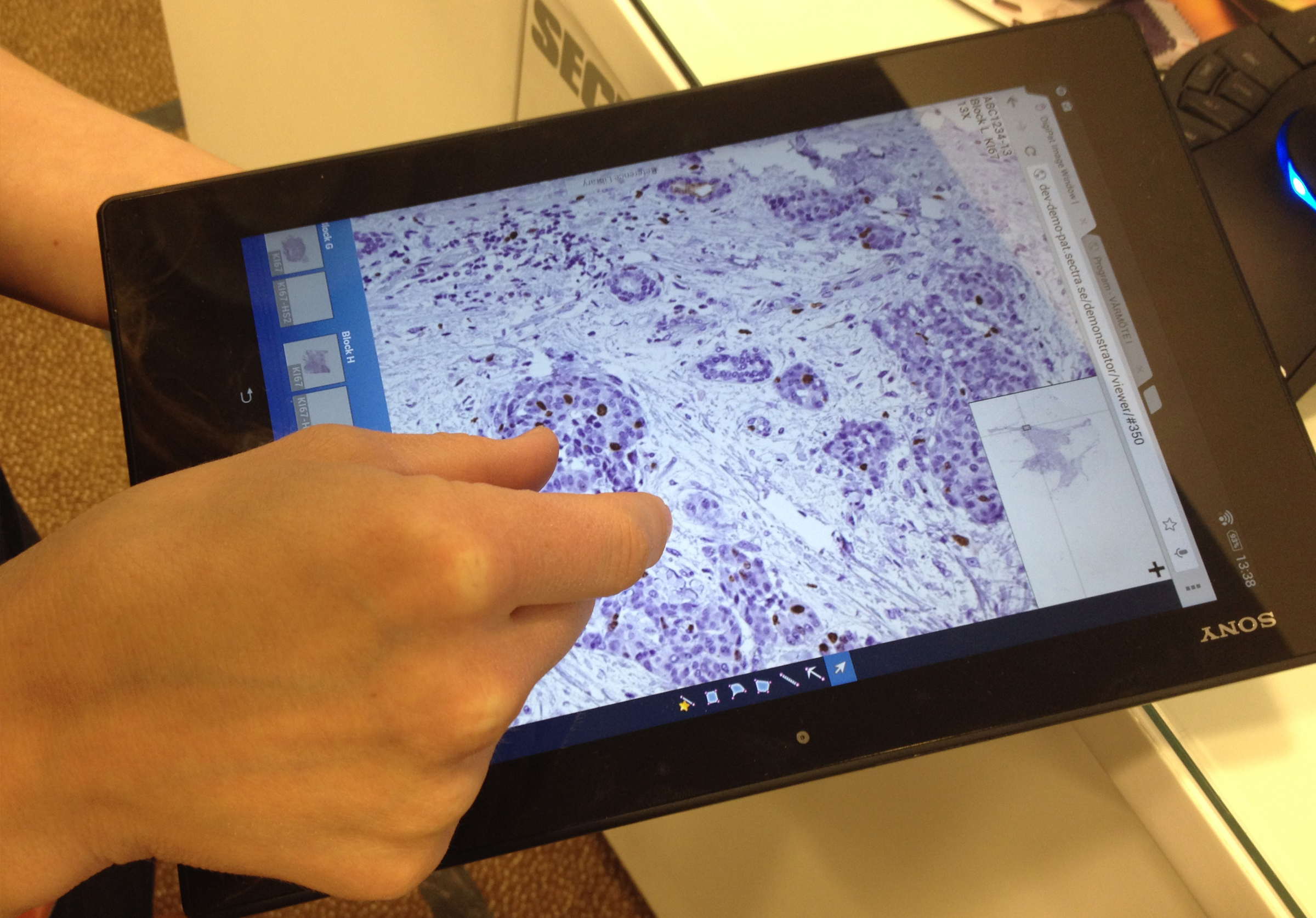 Digital pathology tissue sample view tablet