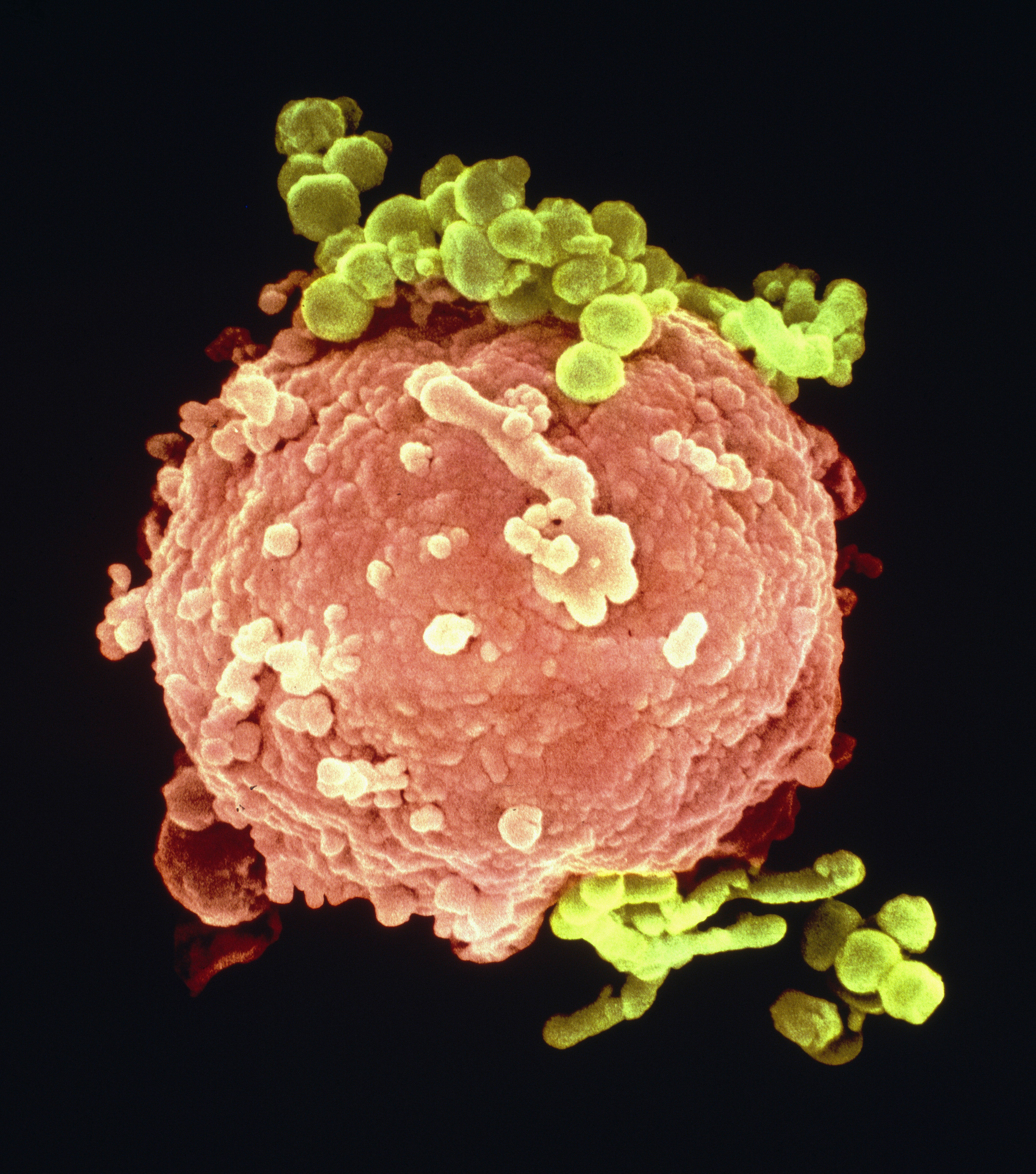 Макрофаги 4. Т лимфоциты под микроскопом. Фагоцит микрофотография. Макрофаги иммунитет. Клетки иммунной системы микрофотография.