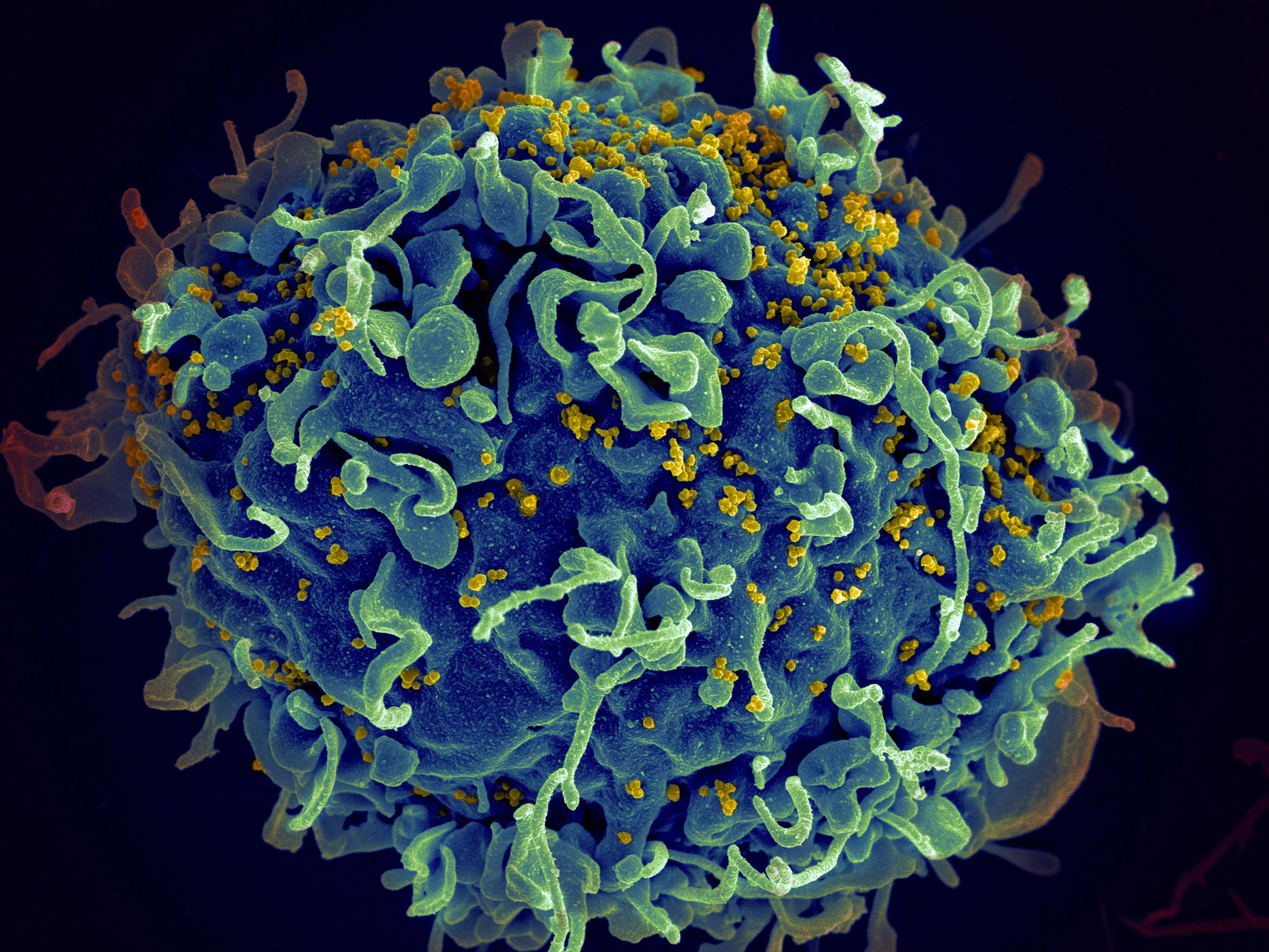 Bild på hiv-virus