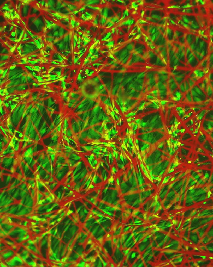 Bland TQ1-fibrerna (röda) trivs och växer embryonala hjärtmuskelceller (gröna)