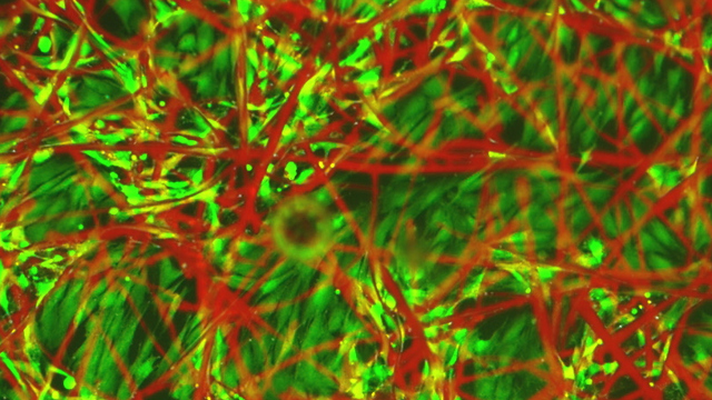Bland TQ1-fibrerna (röda) trivs och växer embryonala hjärtmuskelceller (gröna)
