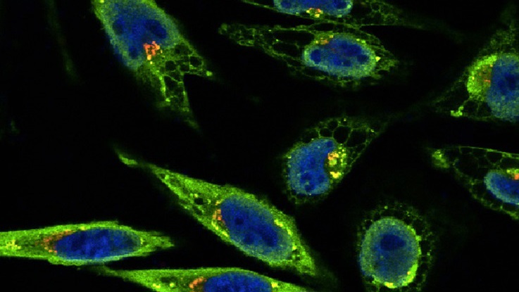 Celler i mikroskop, färgade i grönt och blått.