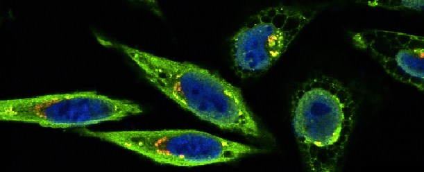 Celler i mikroskop, färgade i grönt och blått.