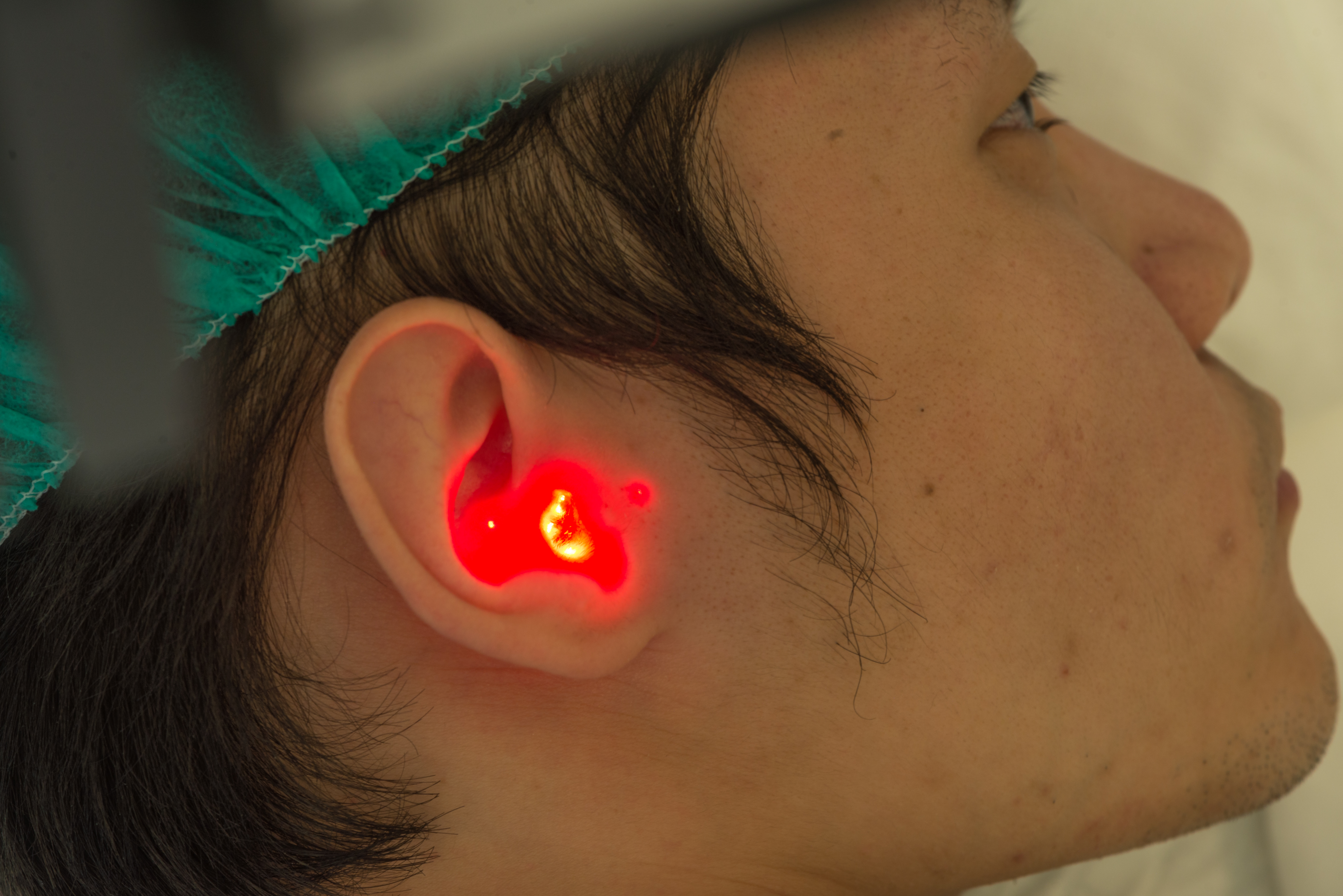 Närbild på undersökning av öra med laserljus