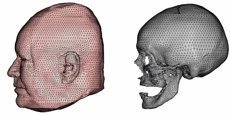 The outer surface (left) and cranial bone (left) of the LiUHEAD.