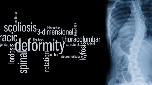 Röntgenbild av deformerad ryggrad