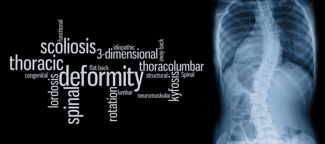 Röntgenbild av deformerad ryggrad