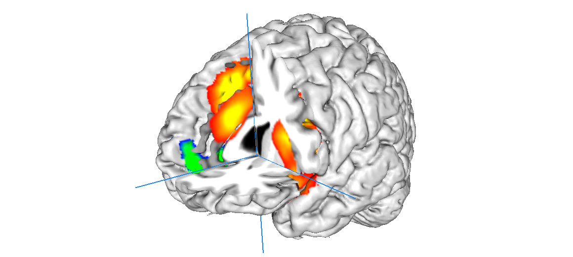 fMRI of the brain