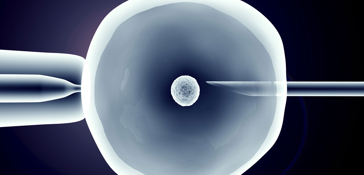 Bild på livmoder