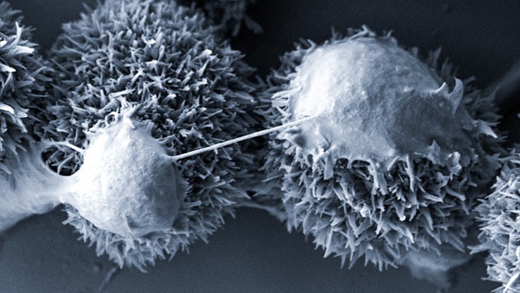 Mänskliga njurceller på nanokristaller