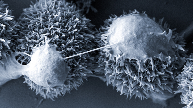 Mänskliga njurceller på nanokristaller