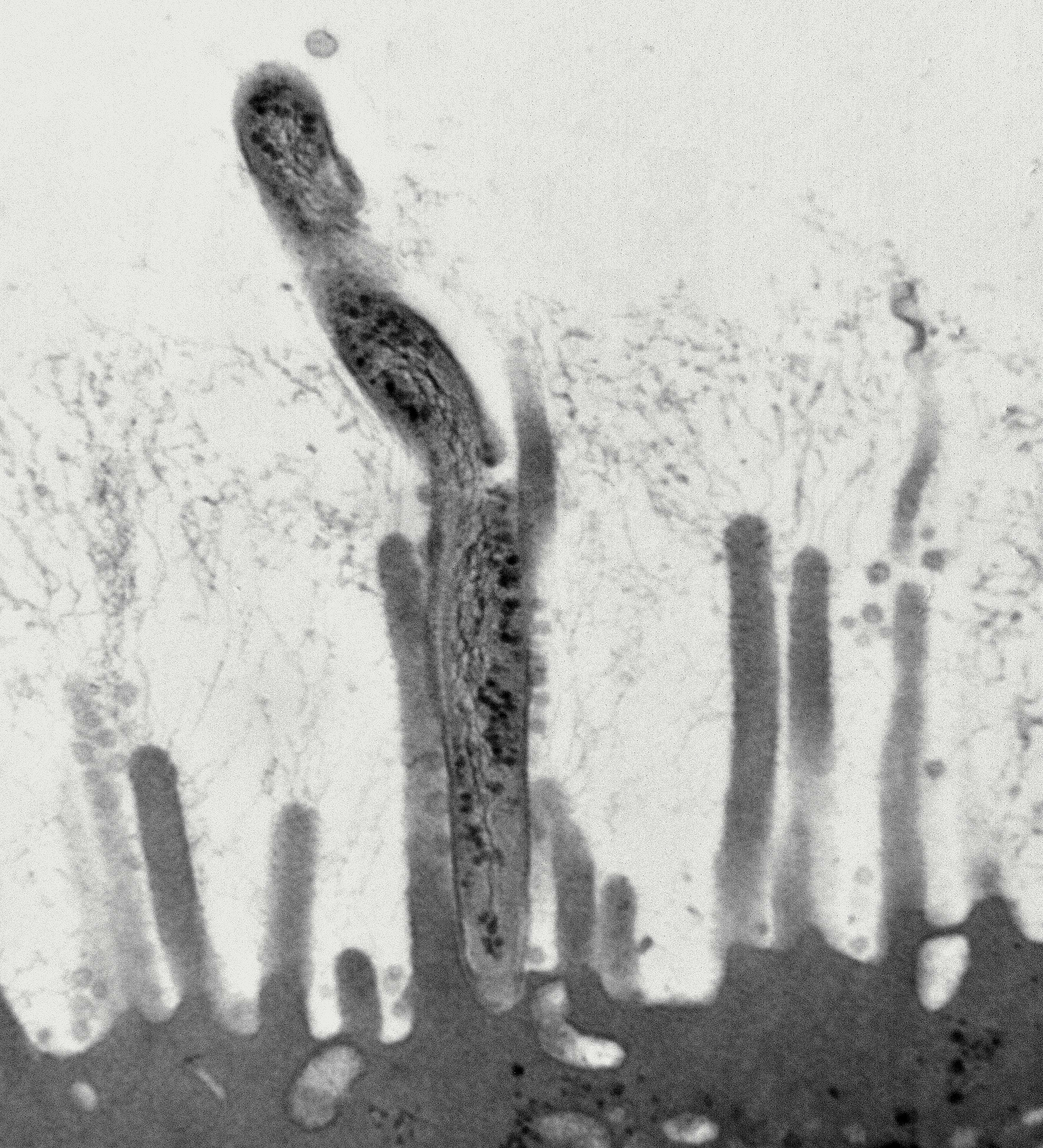 elektronmikroskopibild av bakterie som interagerar med tarmvilli