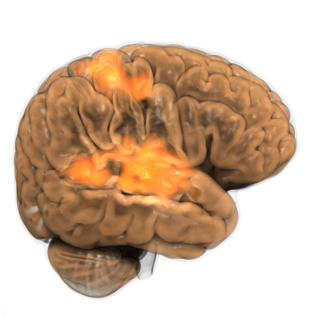Human brain., scanned