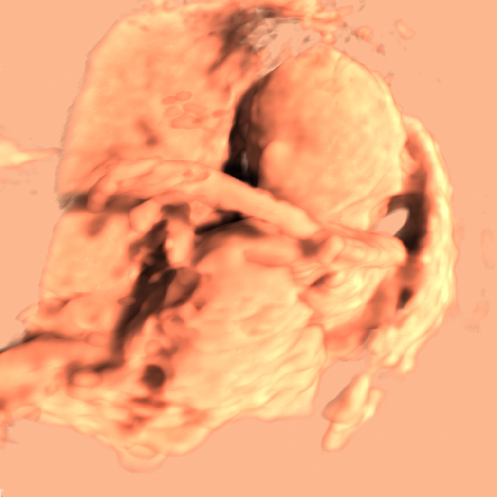 Human organ. scanned
