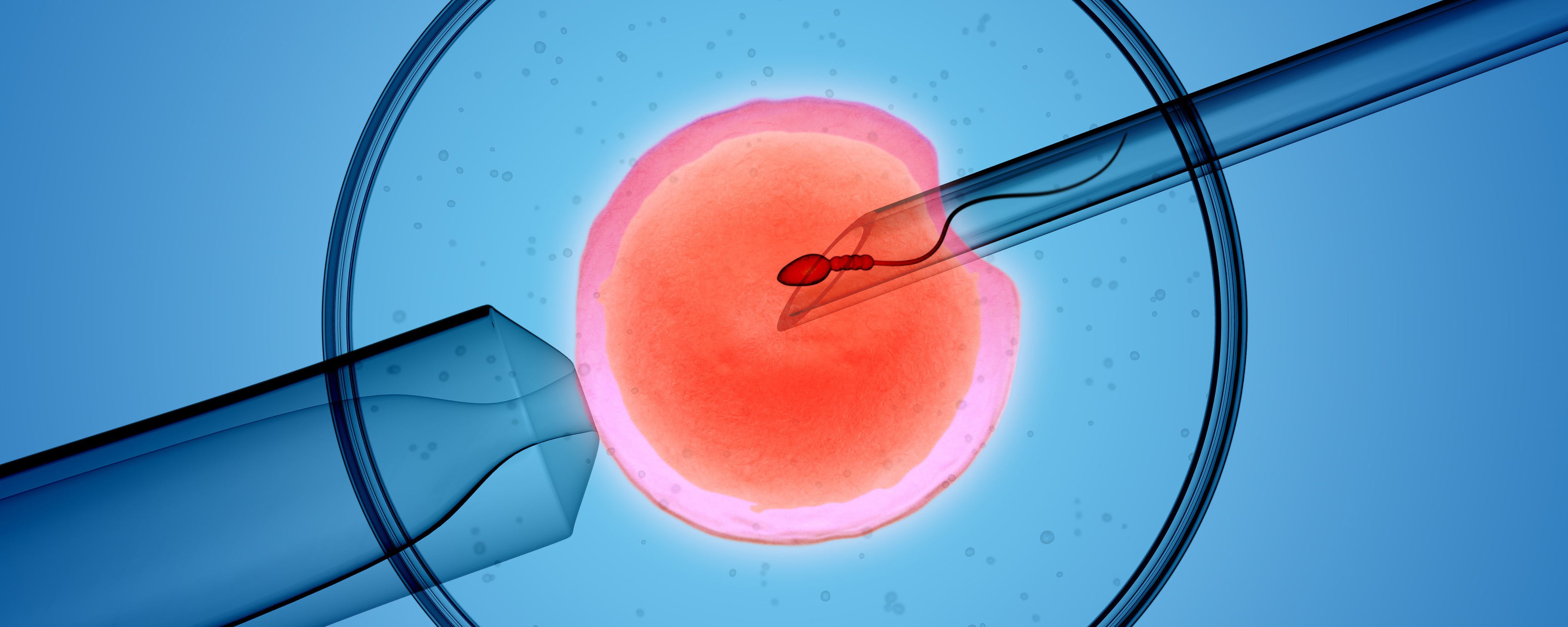 Bilden visar 3D-rendering av icsi-processen (intracytoplasmisk spermieinjektion). 