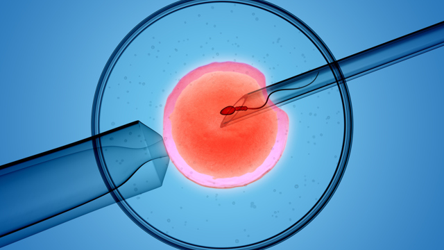 3D rendering av icsi (intracytoplasmic sperm injection) process