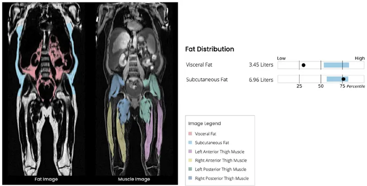 Fat distribution