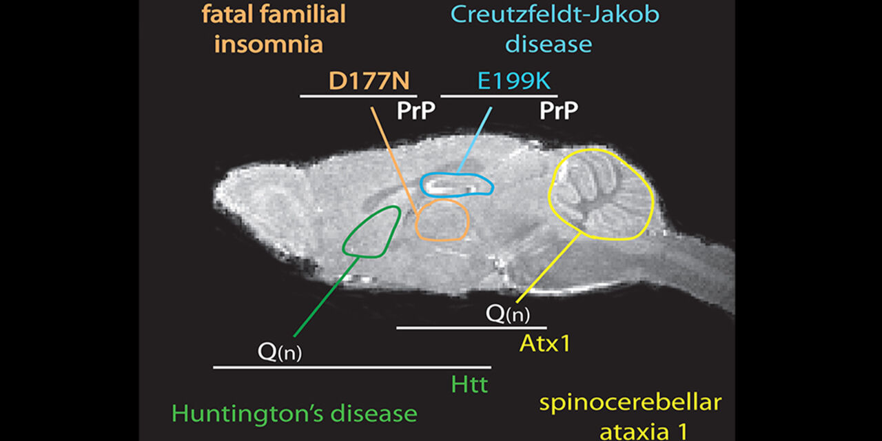 Illustration of various diseased centers in the brain.