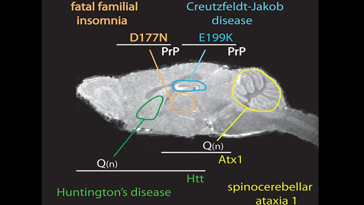 Illustration of various diseased centers in the brain.