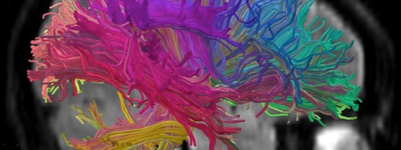 Färgglad avbildning av hjärna