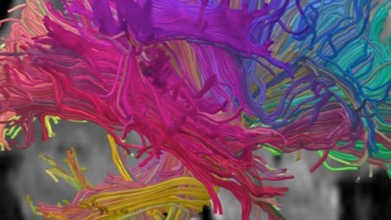 Färgglad avbildning av hjärna