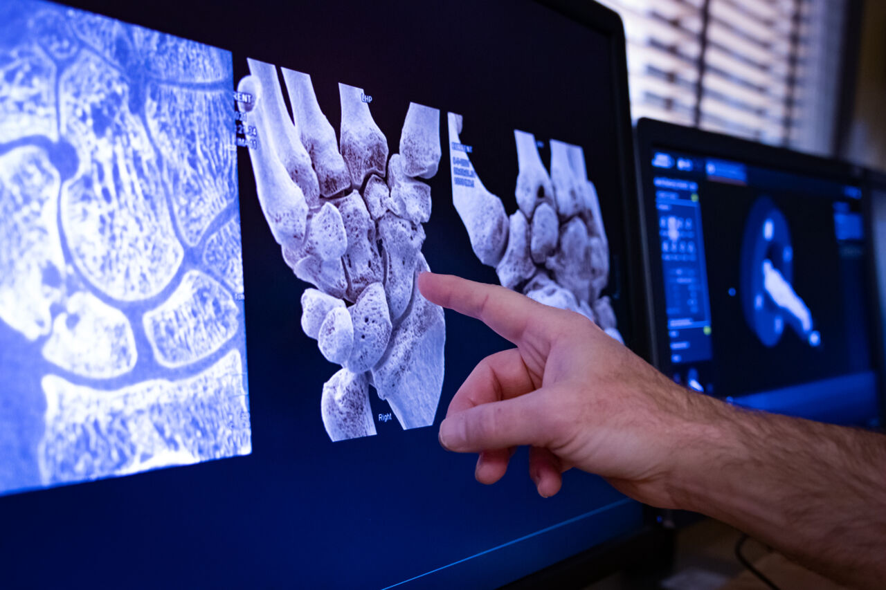 Undersökning av bild från fotonräknare