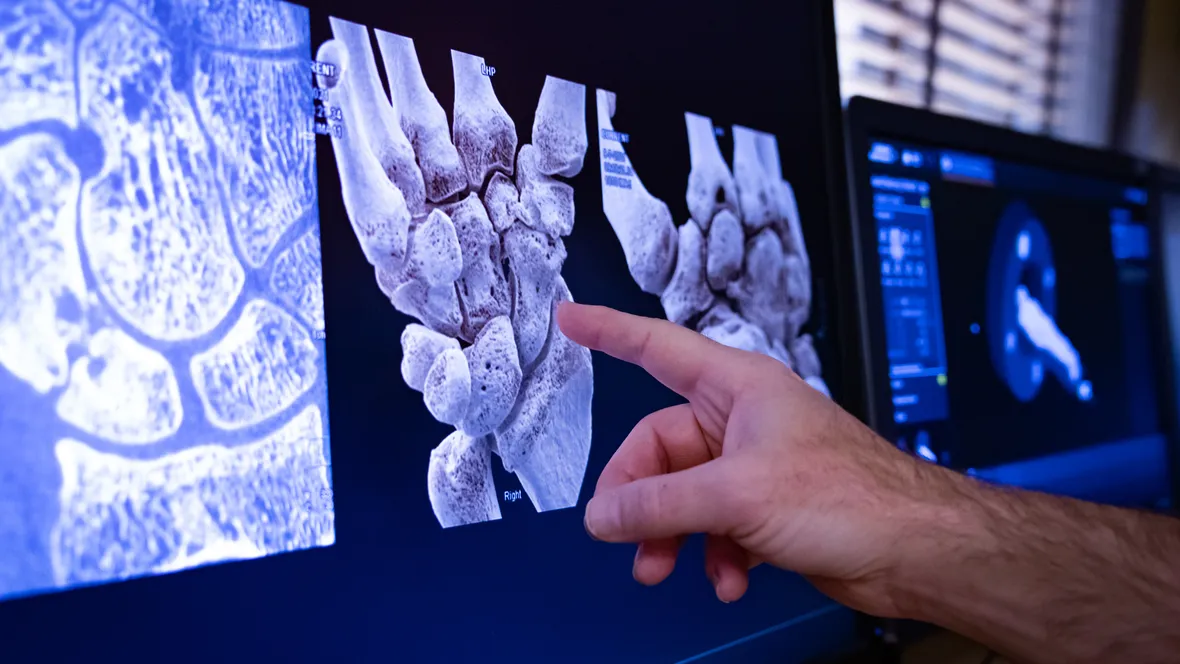 Undersökning av bild från fotonräknare