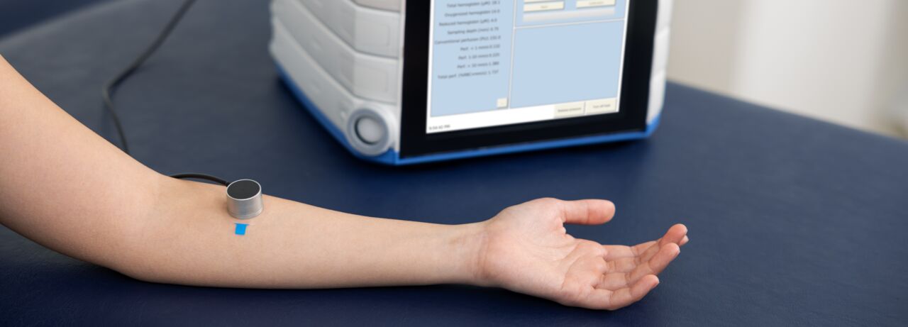 Measurement of a person's arm with PeriFlux 6000 EPOS