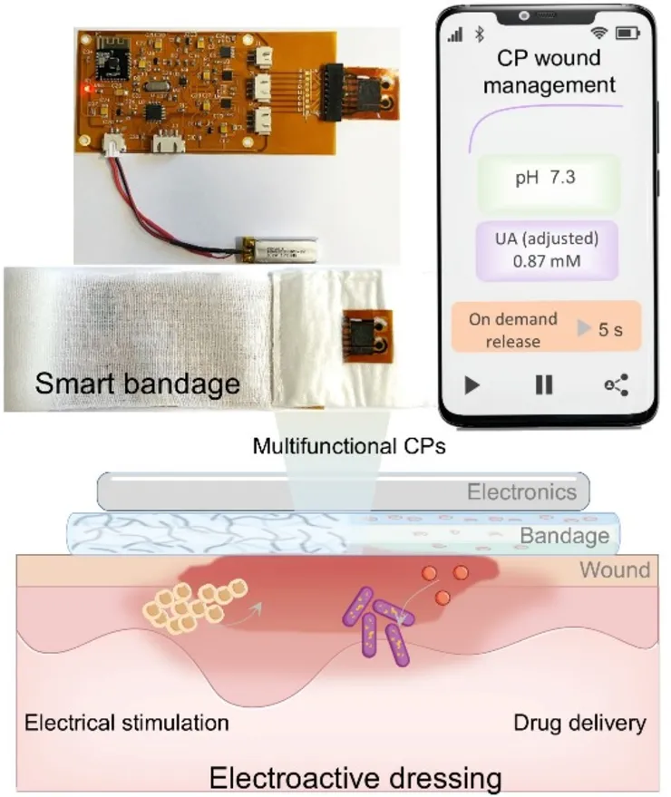 Schematic image of smart bandage and electroactive dressing for wound theranostics.