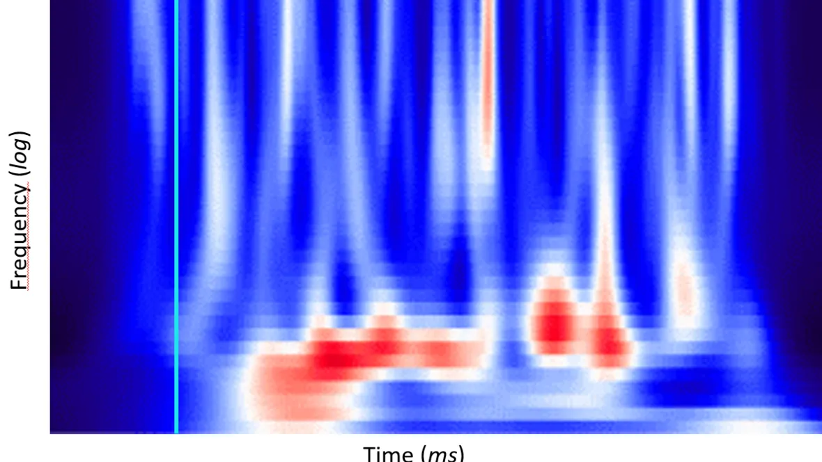 Diagram som visar mätning av hjärnans elektriska aktivitet.