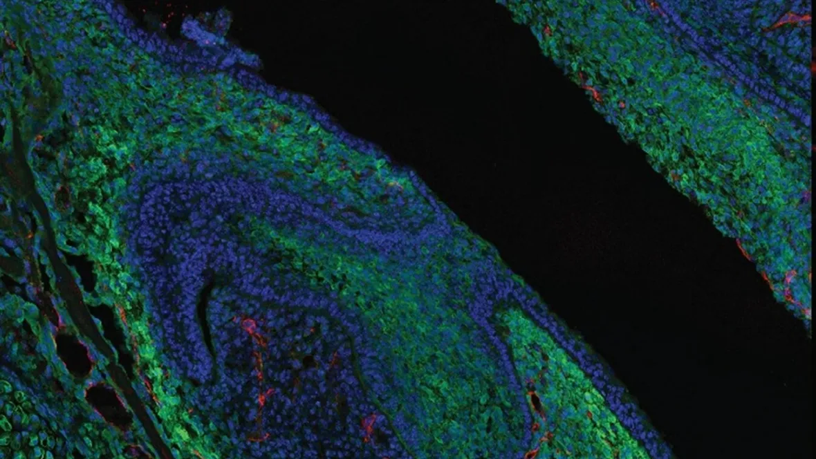 Teaserbild för forskargrupp