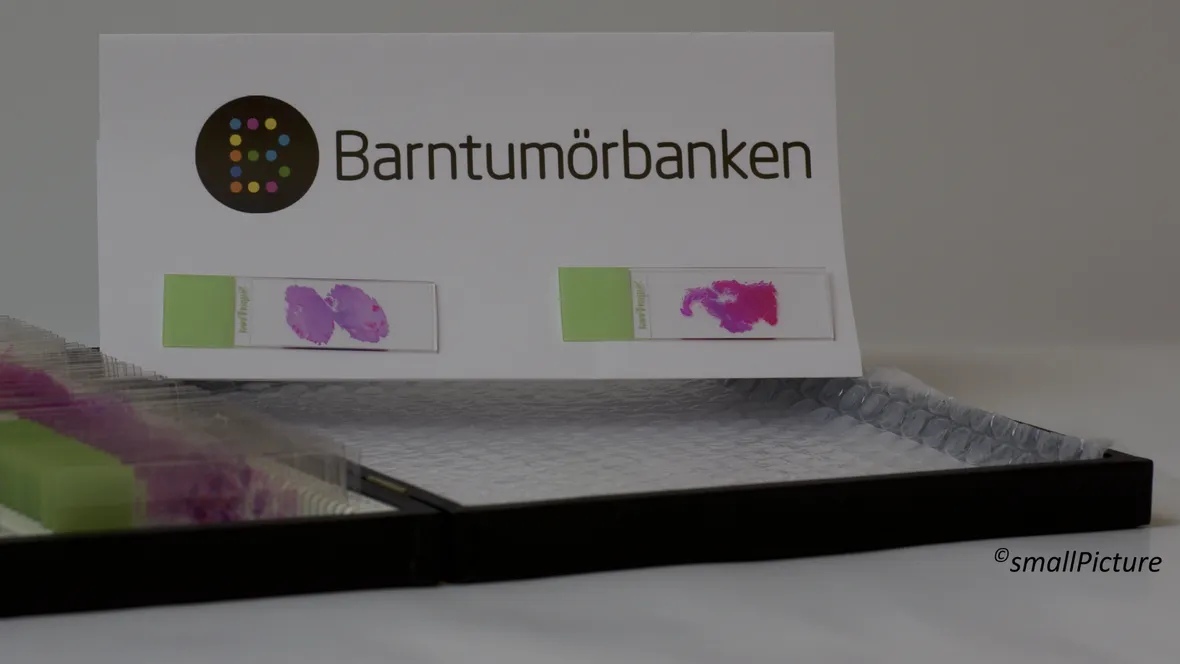 Vävnadsprover från Barntumörbanken.