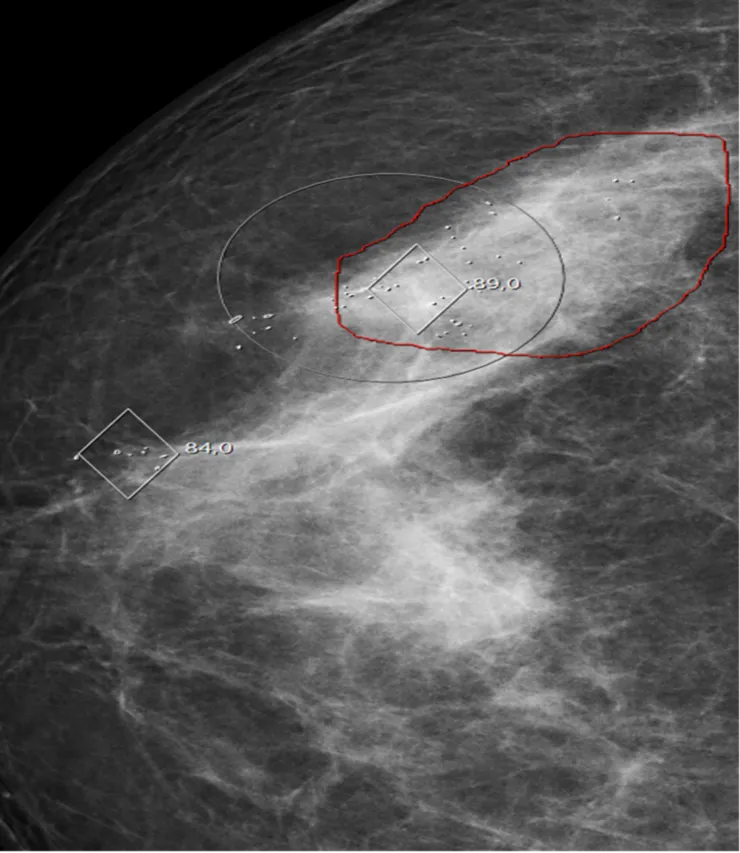 X-ray image