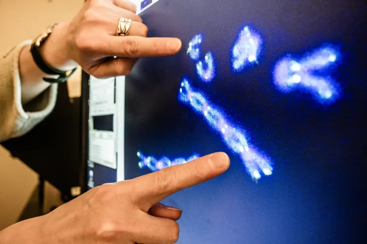 新たな発見が染色体末端の保護機構を解明(New discovery reveals how chromosome ends can be protected)