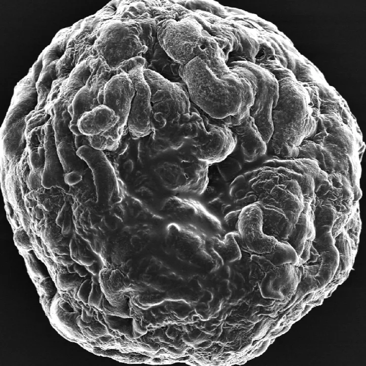 Electron microscopy image of a sphere.