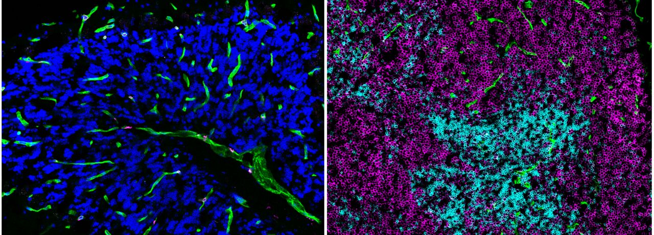Arvelund lab top imagea