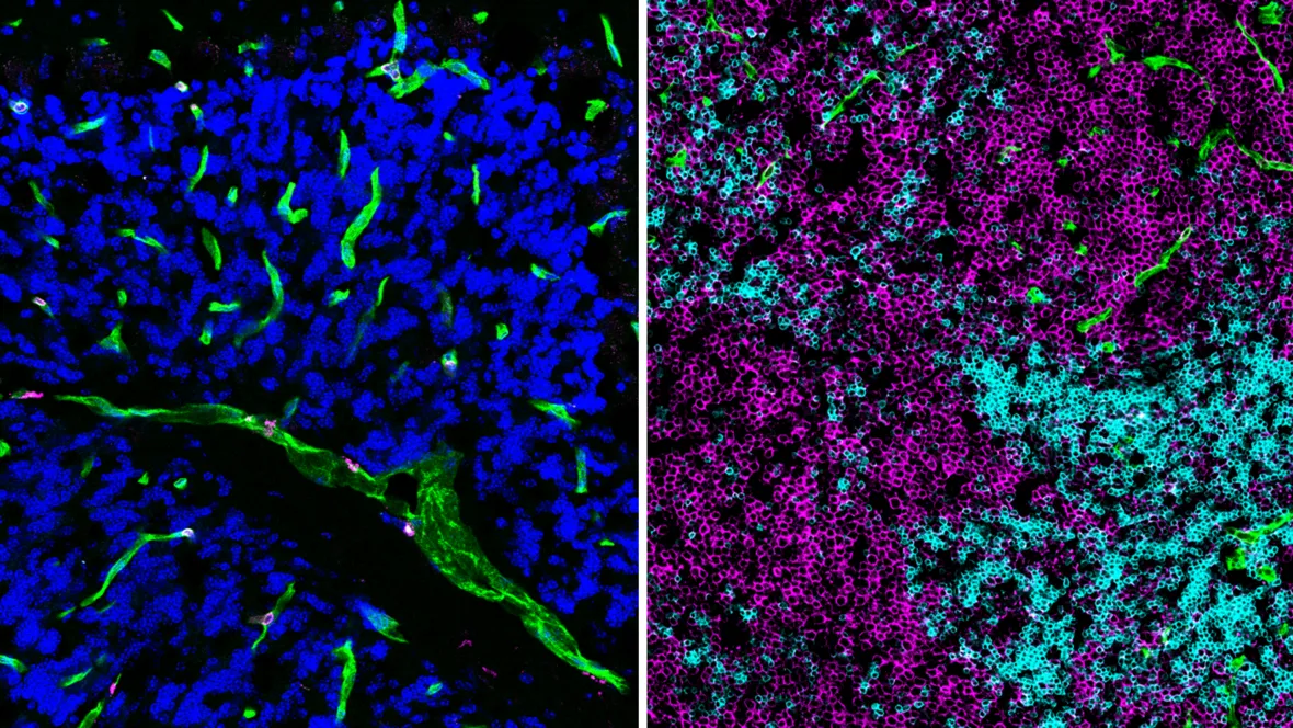 Arvelund lab top imagea