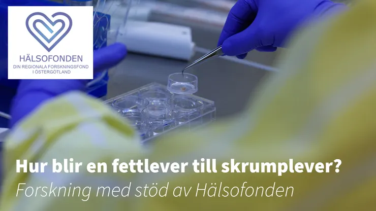 Labbmiljö. Text: Hur blir en fettlever till skrumplever? Forskning med stöd av Hälsofonden