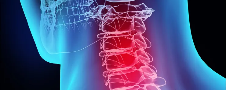 Picture of a spine