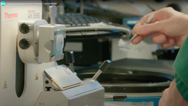 Försättsbild till videon Digital patologi ger kortare väntetider i cancervården.