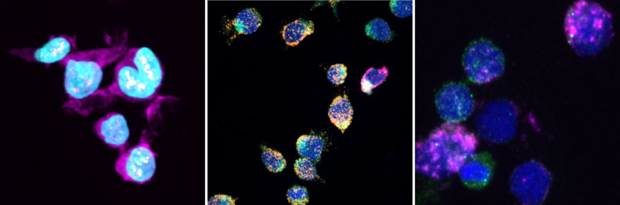 RNA in Adaptive Immunity and Autoimmune Disease.