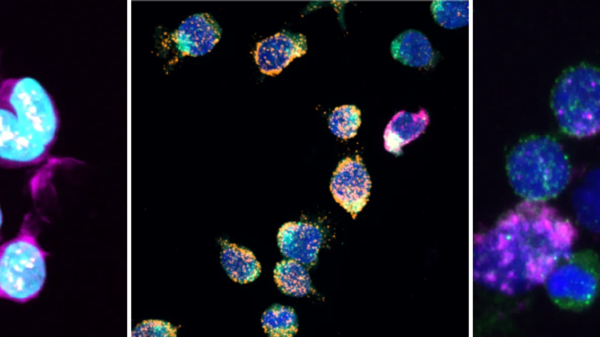 RNA in Adaptive Immunity and Autoimmune Disease.