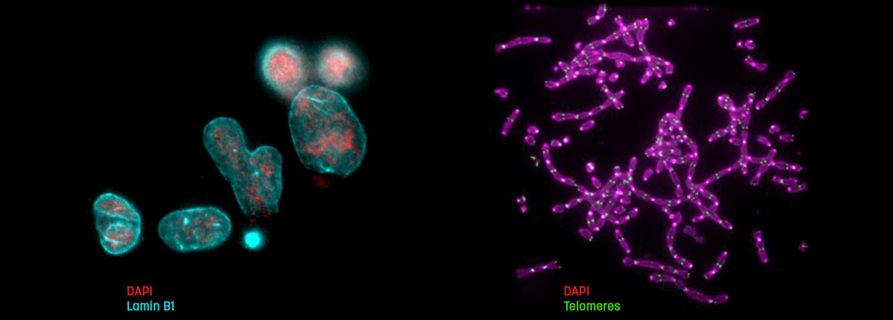 Top image for the Lottersberger lab.