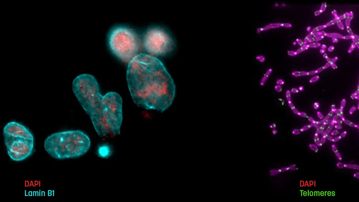 Toppbild Lottersberger labbet.